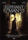 Смотреть «Человек-слон» онлайн фильм в хорошем качестве