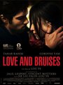 Смотреть «Любовь и ссадины» онлайн фильм в хорошем качестве