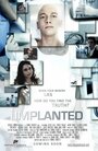 Имплант (2013) кадры фильма смотреть онлайн в хорошем качестве
